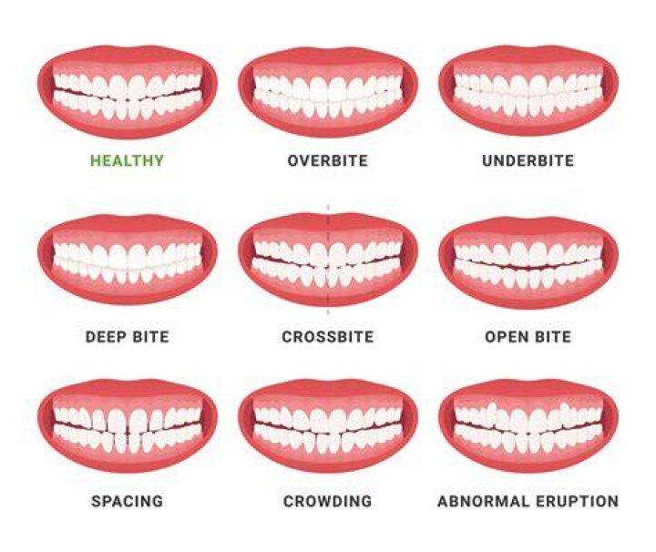 When is it too late for gingivitis?