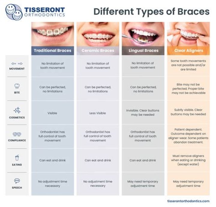 Which braces are more expensive?
