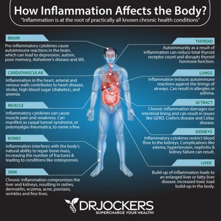 Which ointment is best for inflammation?
