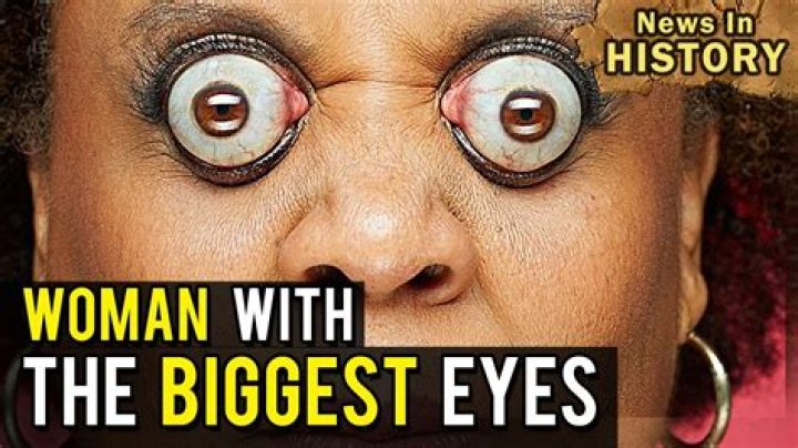 Who has the biggest eyes in the world?