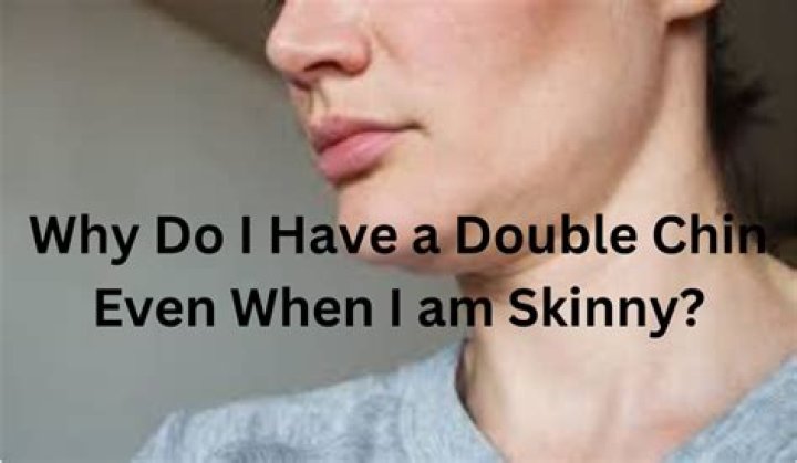 Why am I skinny but have a double chin?