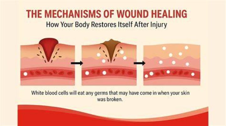 Why are my wounds taking longer to heal?