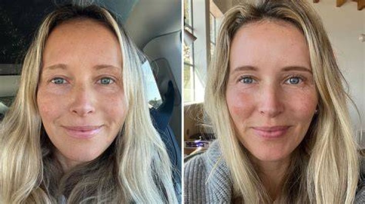 Why do blondes shed more hair?