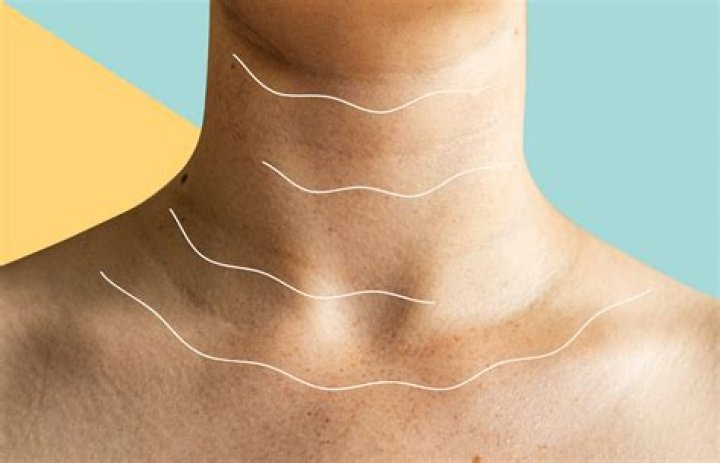 Why do I have lines on my neck at 13?