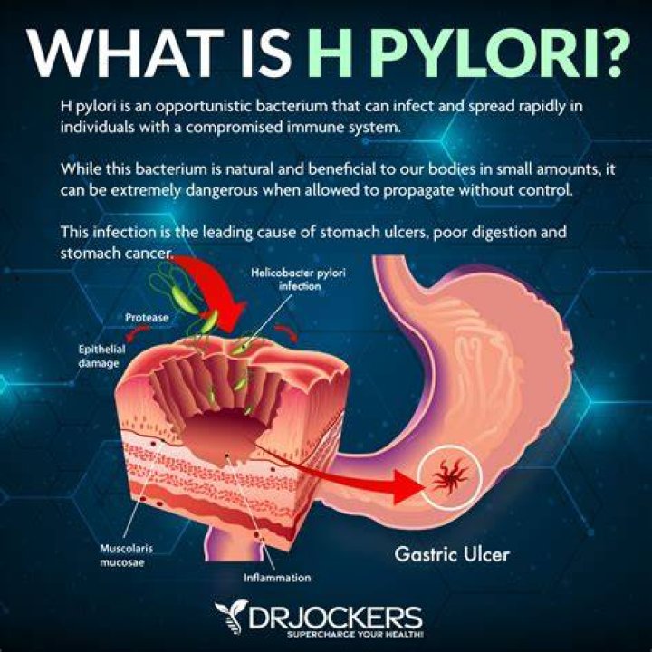 Why do I keep getting H. pylori?