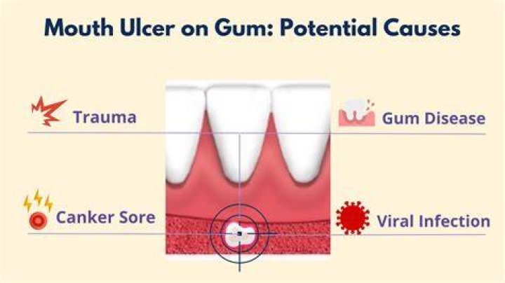Why do my canine gums hurt?