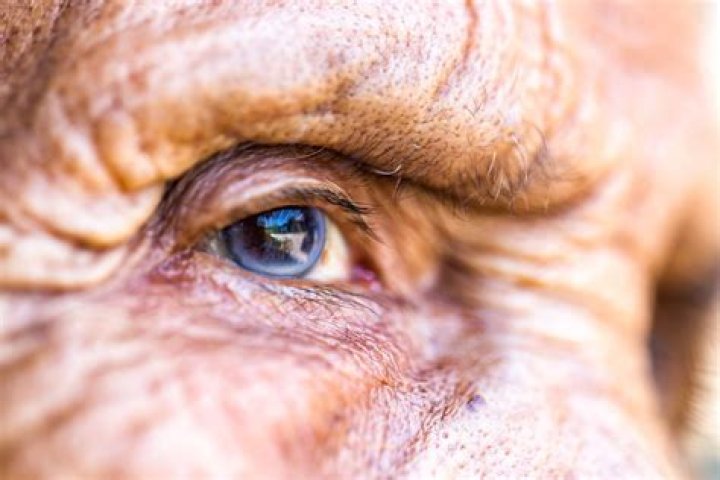 Why do old people's eyes turn blue?
