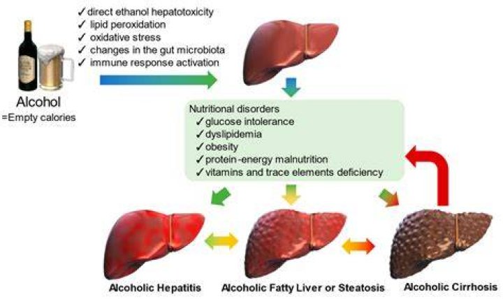 Why do some heavy drinkers not get cirrhosis?