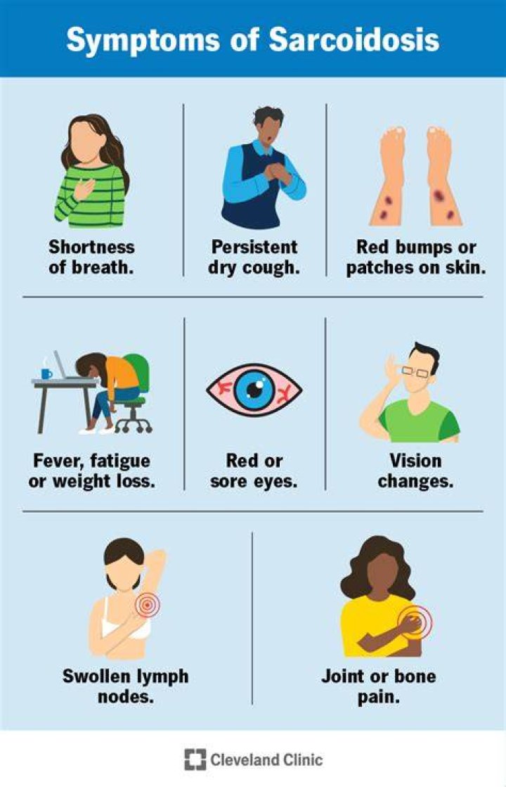 Why do you cough with sarcoidosis?