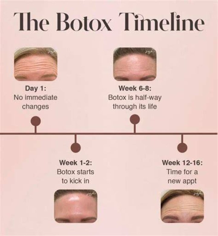 Why does Botox make skin shiny?