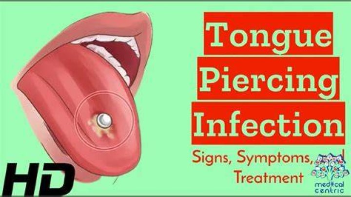 Why does my breath smell after tongue piercing?