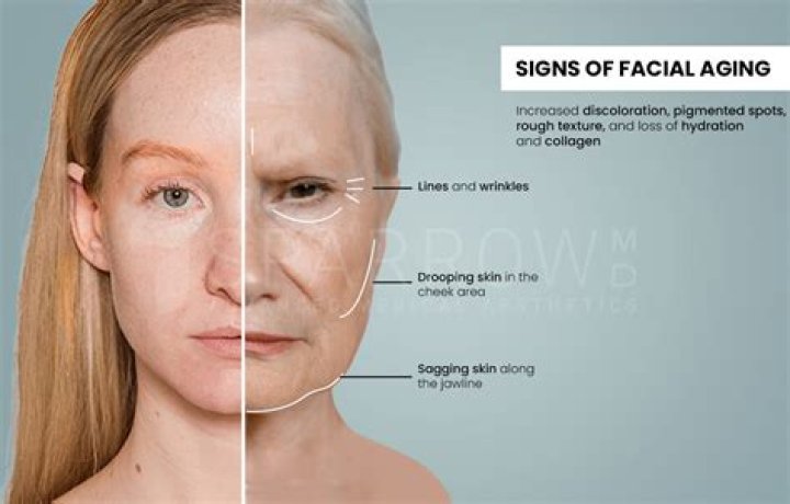 Why is my face so red after HydraFacial?