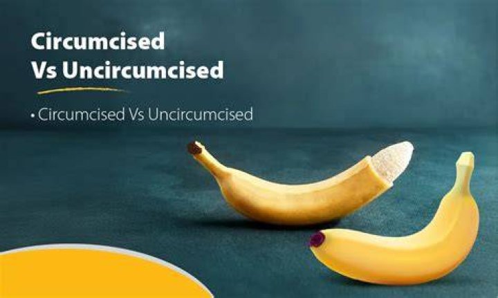 Why should I not circumcise my son?