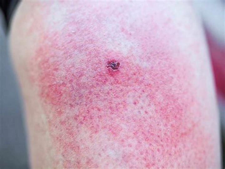 Will a rat bite me in my sleep?