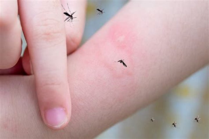 Will mosquitoes bite your face?